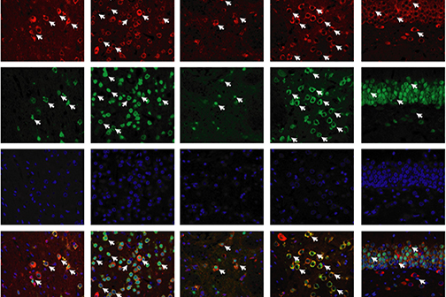 neurons